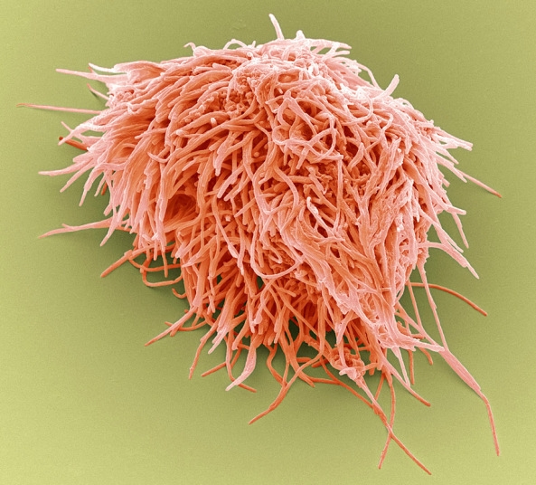 你看过这样的吗?显微镜下的口腔:这么恐怖