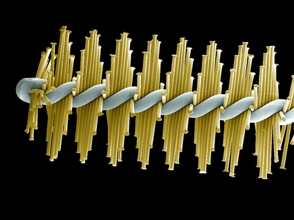 你看过这样的吗?显微镜下的口腔:这么恐怖