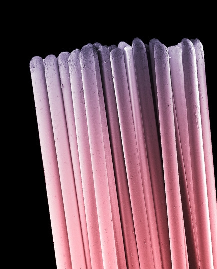 你看过这样的吗?显微镜下的口腔:这么恐怖